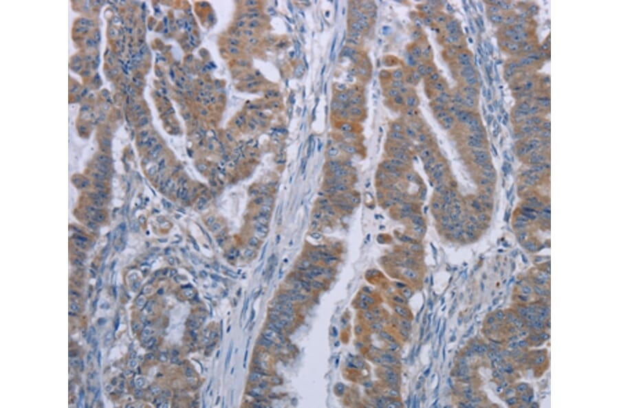Immunohistochemistry - LYN Antibody from Signalway Antibody (36592) - Antibodies.com
