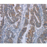 Immunohistochemistry - LYN Antibody from Signalway Antibody (36592) - Antibodies.com