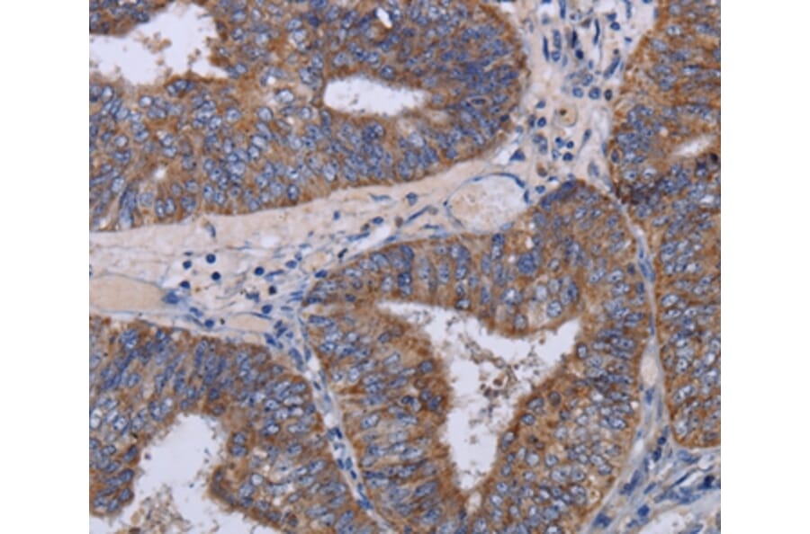 Immunohistochemistry - MT3 Antibody from Signalway Antibody (36609) - Antibodies.com