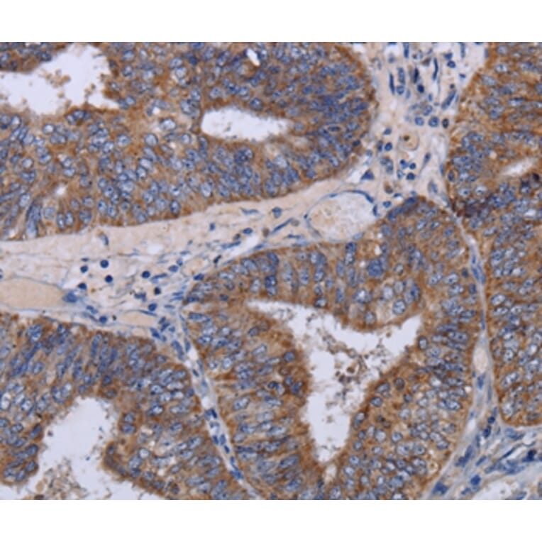 Immunohistochemistry - MT3 Antibody from Signalway Antibody (36609) - Antibodies.com