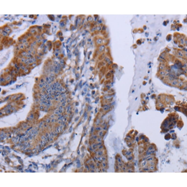 Immunohistochemistry - MT3 Antibody from Signalway Antibody (36609) - Antibodies.com