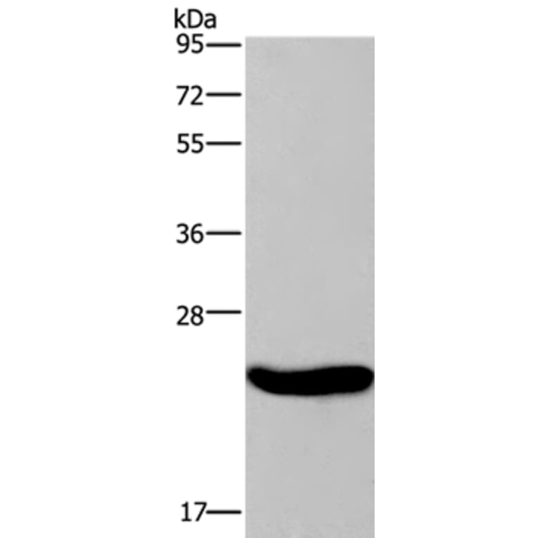 CRH Antibody from Signalway Antibody (36806) - Antibodies.com