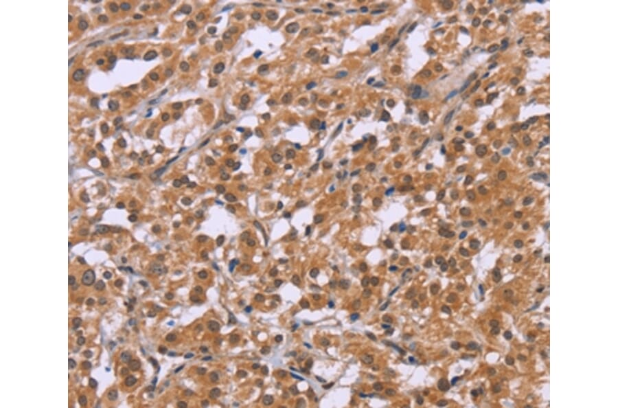 Immunohistochemistry - CRH Antibody from Signalway Antibody (36806) - Antibodies.com
