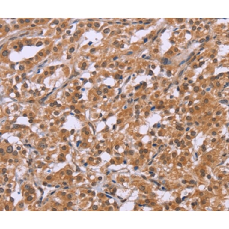 Immunohistochemistry - CRH Antibody from Signalway Antibody (36806) - Antibodies.com