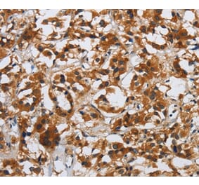 Immunohistochemistry - DSP Antibody from Signalway Antibody (36829) - Antibodies.com