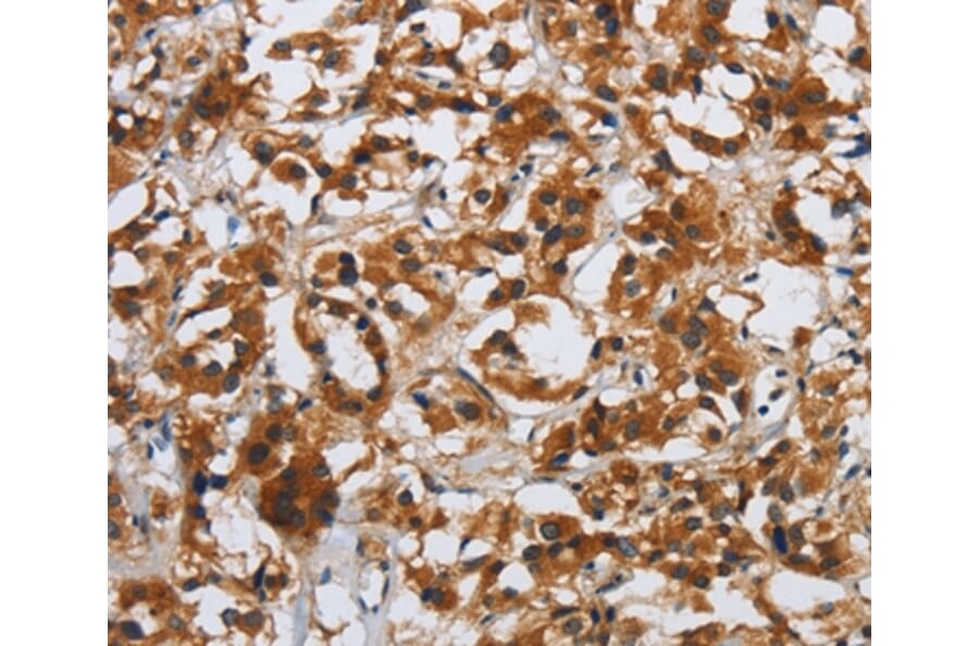 Immunohistochemistry - DSP Antibody from Signalway Antibody (36829) - Antibodies.com