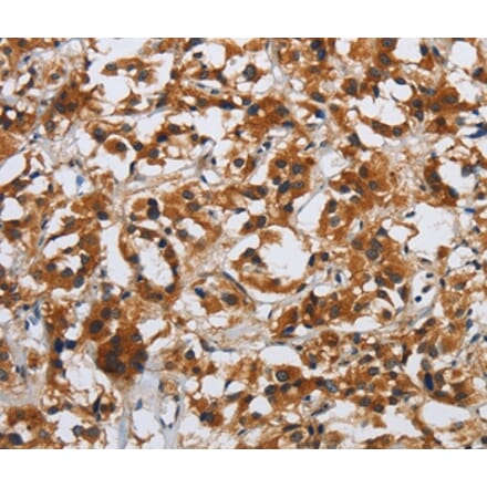 Immunohistochemistry - DSP Antibody from Signalway Antibody (36829) - Antibodies.com
