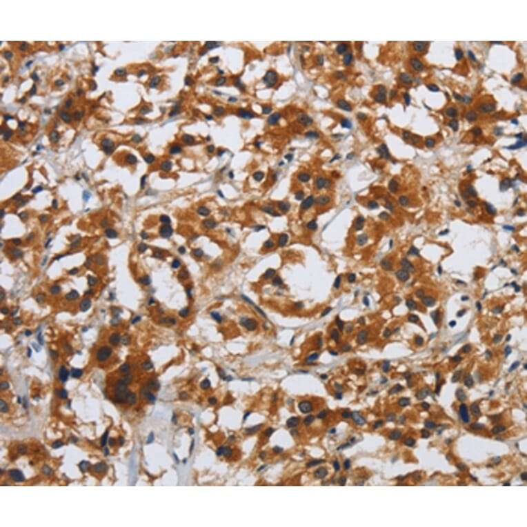 Immunohistochemistry - DSP Antibody from Signalway Antibody (36829) - Antibodies.com