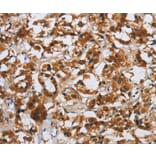 Immunohistochemistry - DSP Antibody from Signalway Antibody (36829) - Antibodies.com