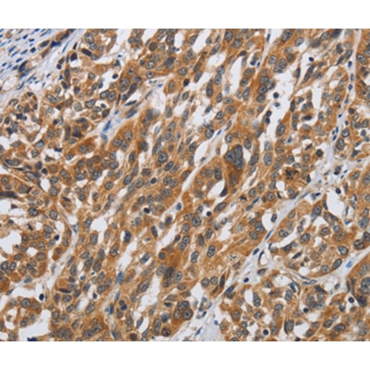 Immunohistochemistry - DSP Antibody from Signalway Antibody (36829) - Antibodies.com