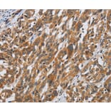 Immunohistochemistry - DSP Antibody from Signalway Antibody (36829) - Antibodies.com