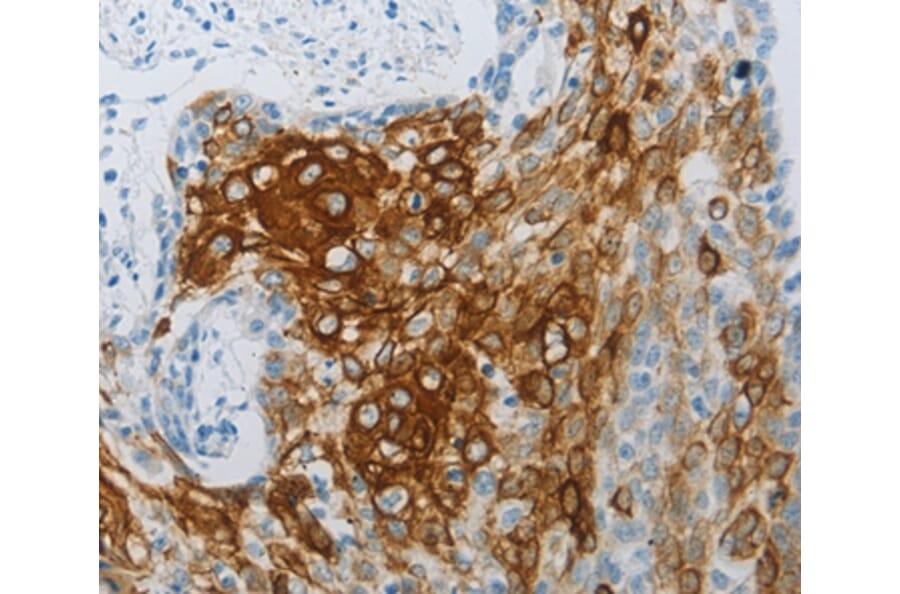 Immunohistochemistry - FLG Antibody from Signalway Antibody (36854) - Antibodies.com