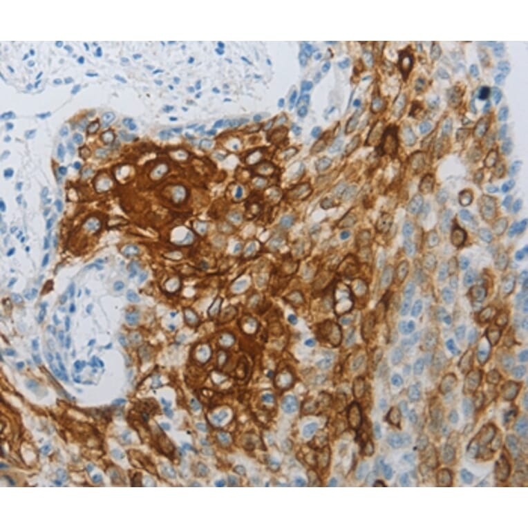 Immunohistochemistry - FLG Antibody from Signalway Antibody (36854) - Antibodies.com