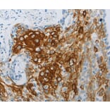 Immunohistochemistry - FLG Antibody from Signalway Antibody (36854) - Antibodies.com