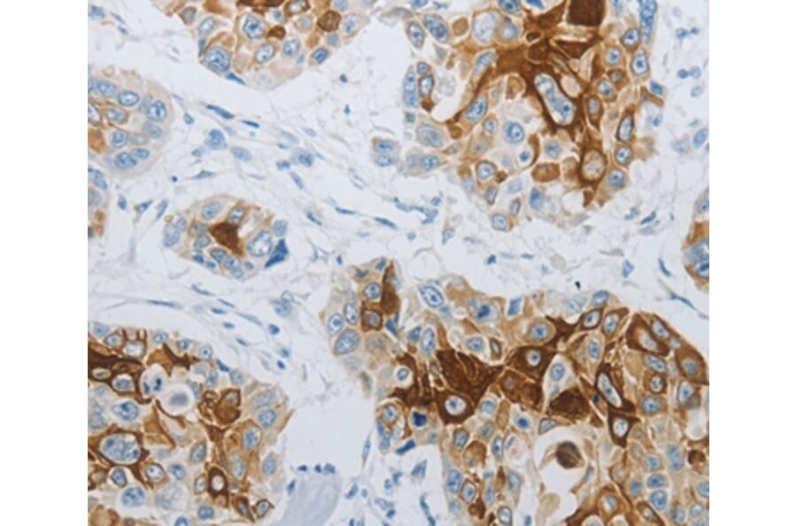 Immunohistochemistry - FLG Antibody from Signalway Antibody (36854) - Antibodies.com