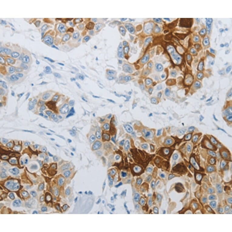 Immunohistochemistry - FLG Antibody from Signalway Antibody (36854) - Antibodies.com