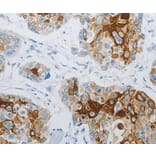 Immunohistochemistry - FLG Antibody from Signalway Antibody (36854) - Antibodies.com