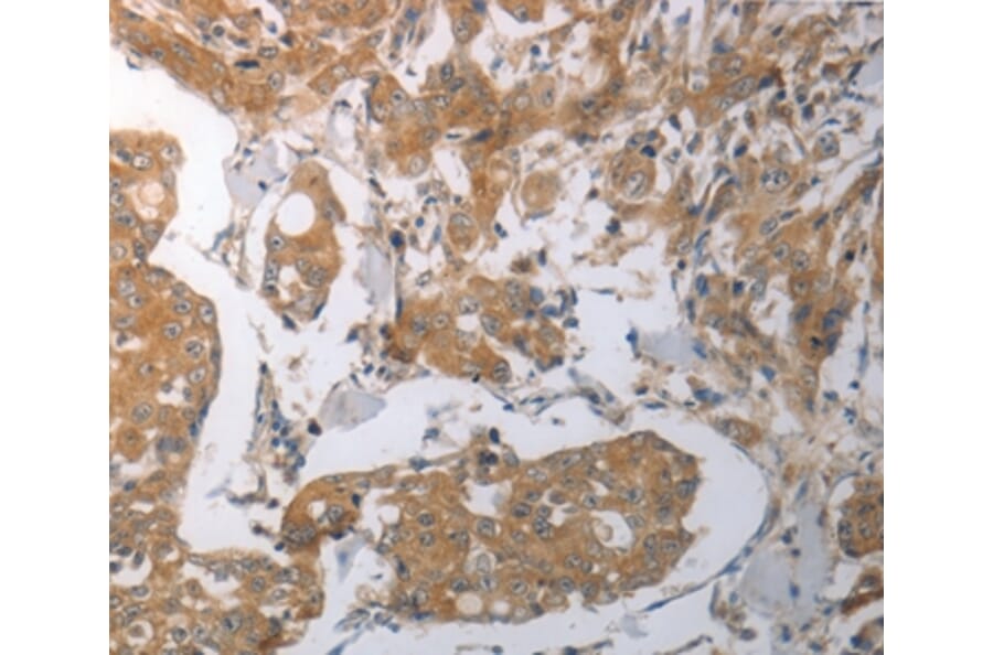 Immunohistochemistry - SHH Antibody from Signalway Antibody (37028) - Antibodies.com