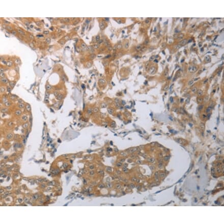 Immunohistochemistry - SHH Antibody from Signalway Antibody (37028) - Antibodies.com