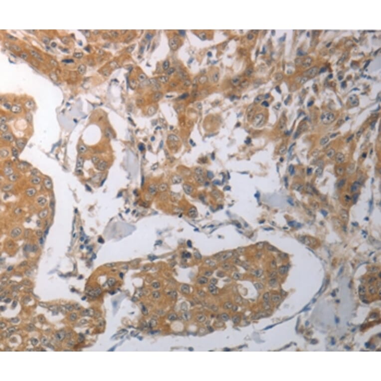 Immunohistochemistry - SHH Antibody from Signalway Antibody (37028) - Antibodies.com