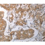 Immunohistochemistry - SHH Antibody from Signalway Antibody (37028) - Antibodies.com