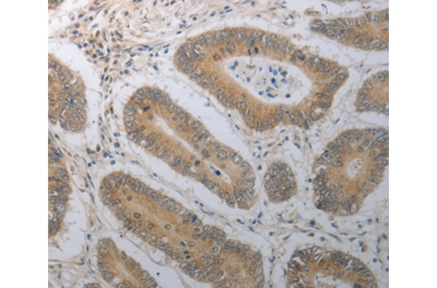Immunohistochemistry - SHH Antibody from Signalway Antibody (37028) - Antibodies.com
