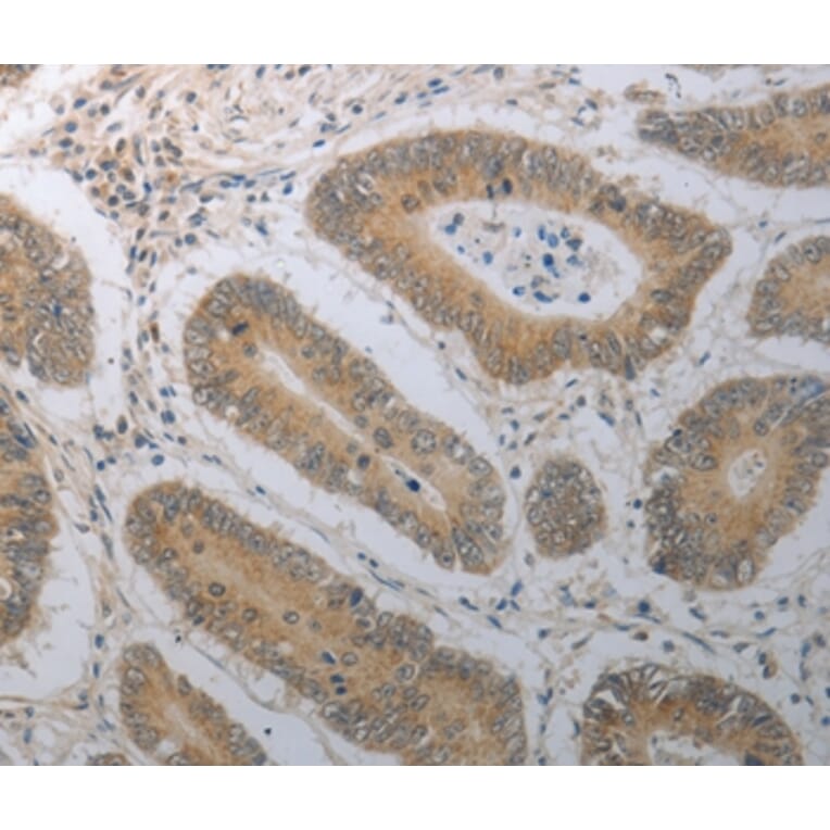 Immunohistochemistry - SHH Antibody from Signalway Antibody (37028) - Antibodies.com