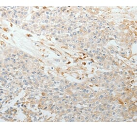 Immunohistochemistry - TNC Antibody from Signalway Antibody (37051) - Antibodies.com