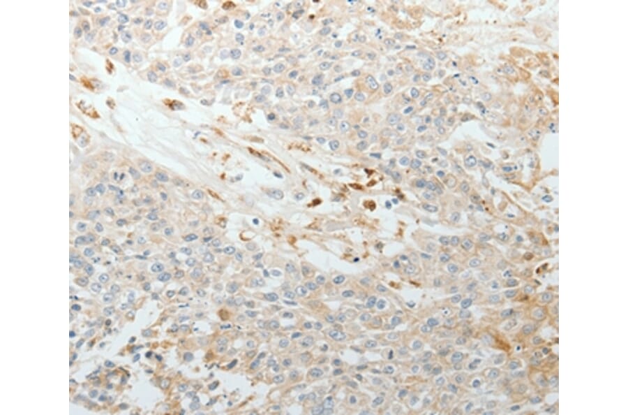 Immunohistochemistry - TNC Antibody from Signalway Antibody (37051) - Antibodies.com