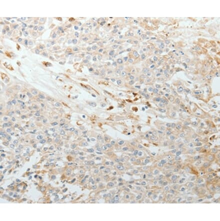 Immunohistochemistry - TNC Antibody from Signalway Antibody (37051) - Antibodies.com