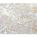Immunohistochemistry - TNC Antibody from Signalway Antibody (37051) - Antibodies.com