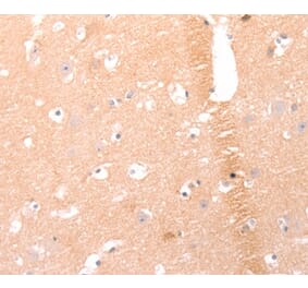 Immunohistochemistry - AMH Antibody from Signalway Antibody (37099) - Antibodies.com