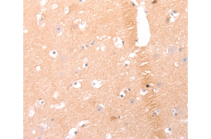 Immunohistochemistry - AMH Antibody from Signalway Antibody (37099) - Antibodies.com