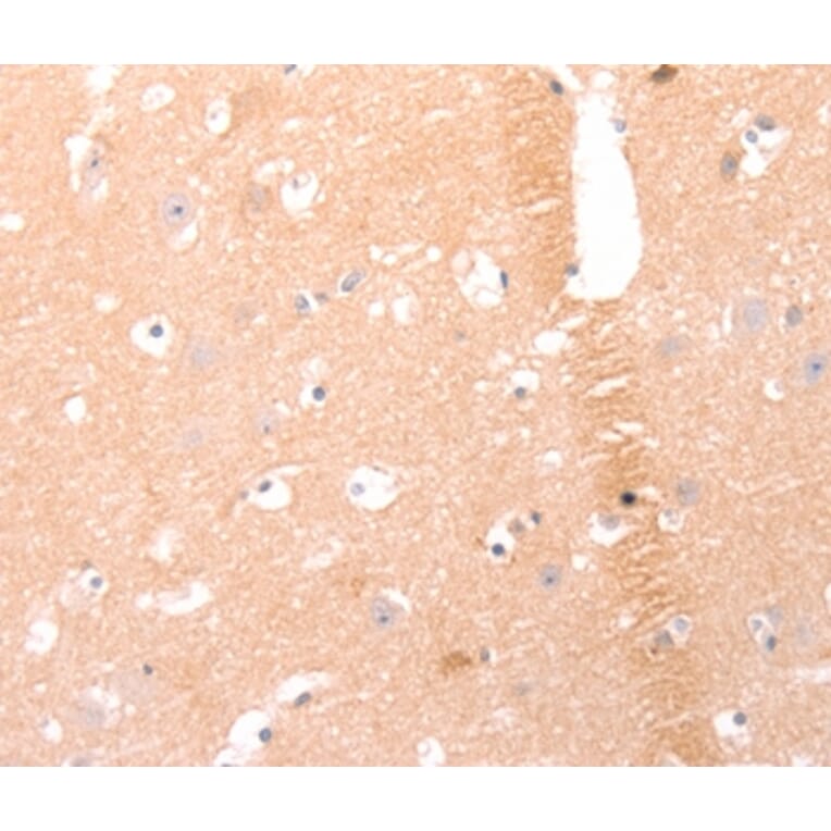 Immunohistochemistry - AMH Antibody from Signalway Antibody (37099) - Antibodies.com