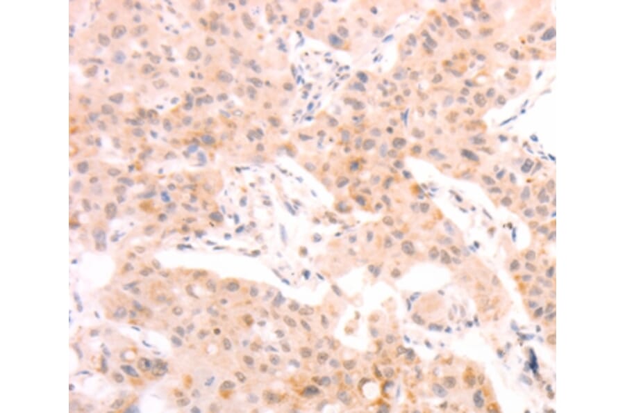 Immunohistochemistry - AMH Antibody from Signalway Antibody (37099) - Antibodies.com