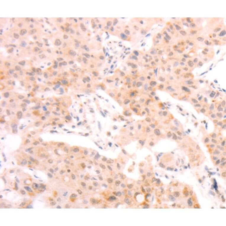 Immunohistochemistry - AMH Antibody from Signalway Antibody (37099) - Antibodies.com