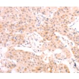 Immunohistochemistry - AMH Antibody from Signalway Antibody (37099) - Antibodies.com