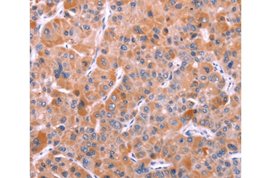 Immunohistochemistry - BCR Antibody from Signalway Antibody (37152) - Antibodies.com