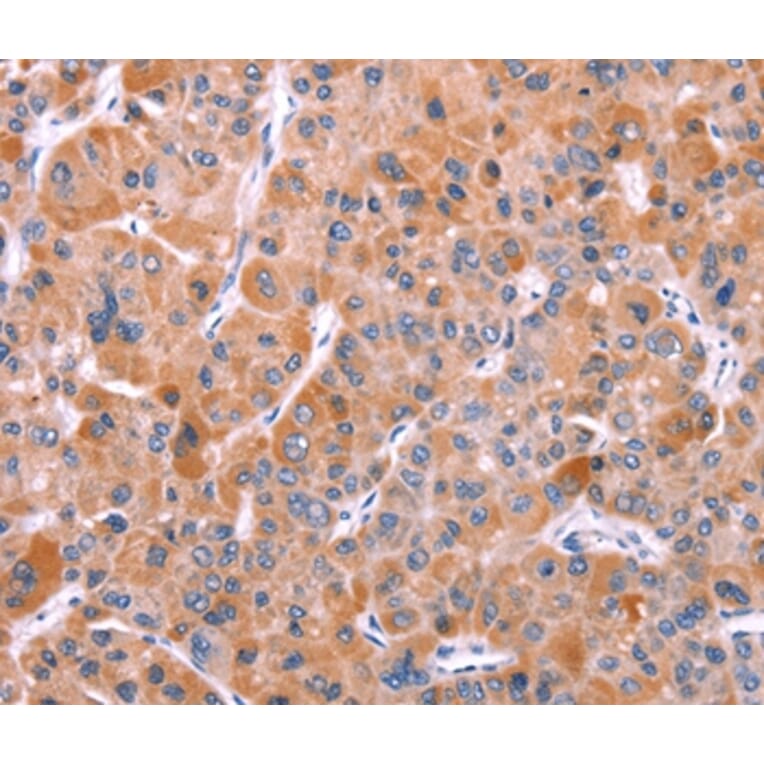 Immunohistochemistry - BCR Antibody from Signalway Antibody (37152) - Antibodies.com