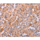 Immunohistochemistry - BCR Antibody from Signalway Antibody (37152) - Antibodies.com