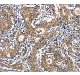 Immunohistochemistry - CR2 Antibody from Signalway Antibody (37160) - Antibodies.com