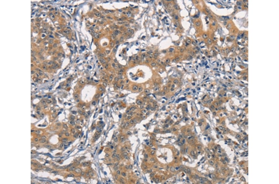Immunohistochemistry - CR2 Antibody from Signalway Antibody (37160) - Antibodies.com