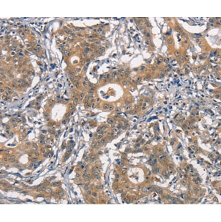 Immunohistochemistry - CR2 Antibody from Signalway Antibody (37160) - Antibodies.com