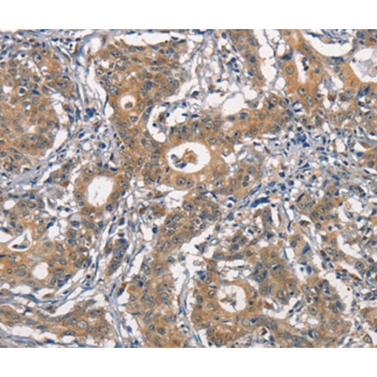 Immunohistochemistry - CR2 Antibody from Signalway Antibody (37160) - Antibodies.com