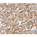 Immunohistochemistry - CR2 Antibody from Signalway Antibody (37160) - Antibodies.com