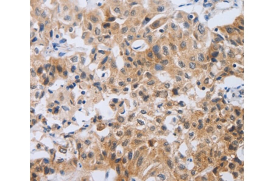 Immunohistochemistry - NEB Antibody from Signalway Antibody (37179) - Antibodies.com