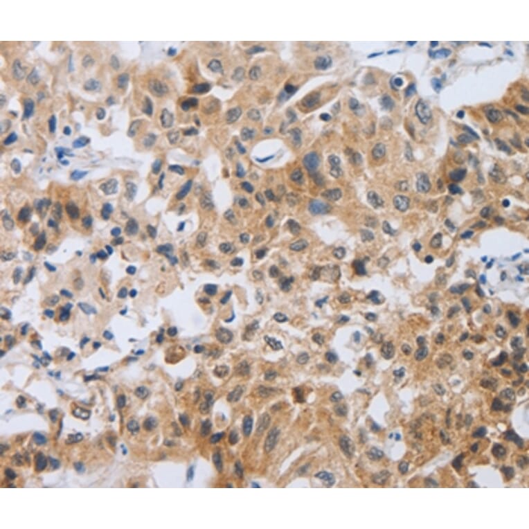 Immunohistochemistry - NEB Antibody from Signalway Antibody (37179) - Antibodies.com