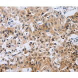 Immunohistochemistry - NEB Antibody from Signalway Antibody (37179) - Antibodies.com