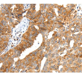 Immunohistochemistry - SCT Antibody from Signalway Antibody (37237) - Antibodies.com