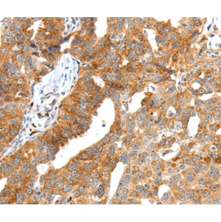 Immunohistochemistry - SCT Antibody from Signalway Antibody (37237) - Antibodies.com